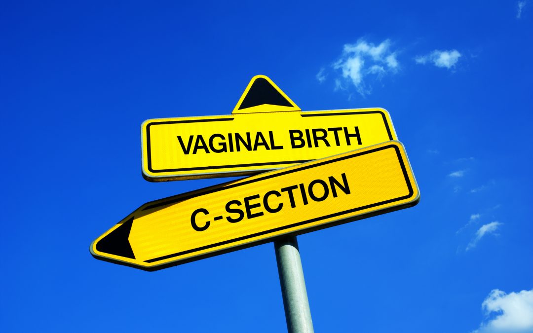 vaginal birth after C-section